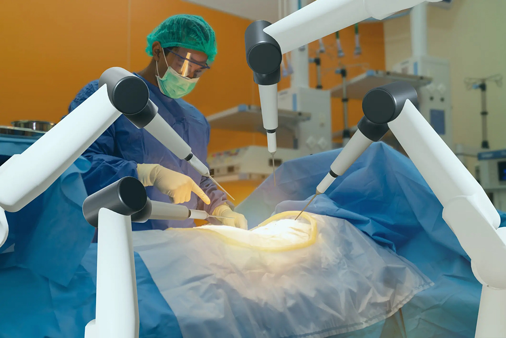 A cirurgia robótica na urologia revolucionou o tratamento de diversas doenças do sistema urinário e do aparelho reprodutor masculino. Com maior precisão, visão tridimensional ampliada e movimentos mais delicados, essa tecnologia permite realizar procedimentos complexos com técnica minimamente invasiva, proporcionando benefícios importantes para pacientes e cirurgiões. E, embora muitas pessoas associem a cirurgia robótica ao tratamento do câncer de próstata, ela pode ser utilizada em diversas condições urológicas em situações bem indicadas, incluindo tumores renais, doenças da bexiga e alterações da junção entre o rim e o ureter. A escolha dessa abordagem depende das características de cada caso e da avaliação do urologista e pode proporcionar incisões menores e recuperação mais ágil. Quer entender quais doenças podem ser tratadas com cirurgia robótica, quando ela é indicada e quais são as principais vantagens em relação às técnicas convencionais? Neste conteúdo, o Dr. Ravendra Moniz (CRM 118114 | RQE 38290), especialista em cirurgia robótica urológica com mais de 15 anos de experiência na área, explica tudo sobre este procedimento. Confira! O que é a cirurgia robótica na urologia? A cirurgia robótica é uma técnica minimamente invasiva realizada por meio de pequenas incisões, nas quais são introduzidos uma câmera de alta definição e instrumentos cirúrgicos acoplados a um sistema robótico. O robô não realiza a cirurgia sozinho. Todos os movimentos são controlados pelo cirurgião, que opera a partir de um console com visão tridimensional ampliada do campo cirúrgico, trazendo precisão ao procedimento. Ou seja, é uma cirurgia robótica assistida. Essa tecnologia oferece estabilidade e amplitude de movimentos, permitindo dissecações mais delicadas e preservação de estruturas importantes. Isso é muito importante em procedimentos urológicos, como é o caso das cirurgias robóticas no rim, nos quais há proximidade entre diversos tecidos importantes e é necessário preservá-los. Quais doenças podem ser tratadas com cirurgia robótica? A cirurgia robótica na urologia pode ser indicada para diferentes doenças benignas e malignas. Entre as principais estão: Câncer de próstata O câncer de próstata localizado é uma das principais indicações da cirurgia robótica. Nesses casos, é realizada a prostatectomia radical robótica, procedimento que remove a próstata e, quando necessário, estruturas adjacentes. A tecnologia robótica permite uma dissecação mais precisa ao redor da próstata, favorecendo a preservação dos nervos responsáveis pela continência urinária e pela função erétil sempre que isso é possível. Assim, permite mais tranquilidade e qualidade de vida para os pacientes, reduzindo riscos de uma preocupação relevante relacionada à cirurgia robótica da próstata e impotência, por exemplo. Veja as possibilidades para a vida sexual após cirurgia robótica neste conteúdo Tumor renal (câncer de rim) Pacientes diagnosticados com tumor renal também podem se beneficiar da cirurgia robótica do rim. Dependendo do tamanho e da localização da lesão, pode ser realizada uma nefrectomia parcial robótica, que remove apenas o tumor e preserva o restante do rim, ou uma nefrectomia radical, quando a retirada completa do órgão é necessária. A preservação da função renal é um dos principais objetivos sempre que possível. Tumores da bexiga Em casos selecionados de câncer de bexiga, a cirurgia robótica Da Vinci XI pode ser utilizada para realizar a cistectomia radical, procedimento que remove a bexiga quando o tumor invade a camada muscular ou apresenta maior agressividade. Além da retirada do tumor, a tecnologia robótica auxilia na reconstrução das vias urinárias, oferecendo uma abordagem menos invasiva do que a cirurgia aberta. Estenose de JUP A cirurgia robótica também é amplamente utilizada no tratamento da estenose da junção ureteropiélica, condição que dificulta a passagem da urina entre o rim e o ureter. Nesses casos, o procedimento mais comum é a pieloplastia robótica, considerada nos procedimentos devido à alta taxa de sucesso e à precisão da reconstrução (com melhora clínica e radiológica significativa em aproximadamente 98,9% dos casos em seguimento médio de 50 meses). Cistos renais complexos Alguns cistos renais, principalmente aqueles classificados como complexos ou com suspeita de malignidade, podem necessitar de tratamento cirúrgico. Dependendo das características da lesão, a abordagem robótica permite remover o cisto preservando o máximo possível do tecido renal saudável. Câncer do trato urinário superior Tumores que acometem o ureter ou a pelve renal também podem ser tratados por cirurgia robótica em casos selecionados, permitindo uma abordagem minimamente invasiva e adequada aos princípios oncológicos. Cirurgias reconstrutivas A cirurgia robótica urológica também pode ser empregada em procedimentos reconstrutivos, indicados para corrigir alterações anatômicas ou restaurar a função do trato urinário. Entre as principais aplicações estão a pieloplastia para correção da estenose de Jup, reconstrução do ureter e cirurgias da bexiga. A alta precisão dos movimentos robóticos facilita a realização de suturas delicadas e a preservação dos tecidos saudáveis, contribuindo para melhores resultados funcionais e uma recuperação mais confortável para o paciente. Quais são as vantagens da cirurgia robótica na urologia? A tecnologia da cirurgia robótica na urologia trouxe benefícios importantes tanto para o cirurgião quanto para o paciente. Entre as principais vantagens estão: pequenas incisões; menor sangramento durante a cirurgia; maior precisão dos movimentos; visão tridimensional ampliada do campo operatório; menor dor no pós-operatório; redução do tempo de internação; recuperação mais rápida; retorno mais precoce às atividades diárias; melhor preservação de nervos e vasos sanguíneos em procedimentos delicados. Esses benefícios tornam a cirurgia robótica uma das abordagens mais modernas da urologia atual. Confira mais vantagens da cirurgia robótica para próstata neste conteúdo. Todos os pacientes podem fazer cirurgia robótica? Não necessariamente. Embora a tecnologia ofereça diversas vantagens, a indicação é criteriosa, conforme o quadro e avaliação clínica do profissional. De modo geral, depende de fatores como: tipo da doença; estágio do quadro; tamanho da lesão; estado geral de saúde do paciente; cirurgias anteriores; objetivos do tratamento. Por isso, cada caso deve ser avaliado individualmente pelo urologista e alinhado em consulta. A cirurgia robótica substitui a cirurgia aberta? Em muitos casos, sim. No entanto, isso não significa que a cirurgia aberta deixou de ter espaço. Existem situações específicas em que a cirurgia convencional continua sendo a melhor opção, seja pela complexidade da doença, pelas características anatômicas do paciente ou por outras condições clínicas. O mais importante é escolher a técnica com confiança, conforme a orientação médica, e que ofereça segurança e potencial de melhores resultados. Como é a recuperação? A recuperação da cirurgia robótica na urologia costuma ser mais rápida e menos dolorosa (que tende a ser de leve a moderada) quando comparada à cirurgia aberta. Embora o tempo varie conforme o procedimento realizado, muitos pacientes recebem alta hospitalar entre um e três dias após a cirurgia e conseguem retomar atividades leves nas semanas seguintes. A caminhada tende a ser liberada já nas primeiras 12 horas. Ainda assim, o período de recuperação deve respeitar as orientações médicas e varia conforme a extensão da cirurgia. O que diz o especialista? Segundo o Dr. Ravendra Moniz: “A cirurgia robótica na urologia ampliou as possibilidades de tratamento na urologia, permitindo abordar doenças complexas com maior precisão e menor impacto para o paciente. Além de oferecer excelentes resultados oncológicos, essa tecnologia favorece uma recuperação mais confortável e, em muitos casos, contribui para preservar funções importantes, como a continência urinária, a função renal e a função sexual. Ainda assim, a escolha da técnica deve sempre ser individualizada, considerando as características da doença e os objetivos do tratamento. Por isso, a avaliação clínica é essencial e deve ser minuciosa, identificando os riscos e benefícios de cada protocolo para o paciente.” Dr. Ravendra Moniz (CRM 118114 | RQE 38290), especialista em cirurgia robótica urológica com mais de 15 anos de experiência na área urológica Cirurgia robótica na urologia: conheça as possibilidades para seu caso Os avanços da cirurgia robótica na urologia permitem tratar diversas doenças com mais precisão, menor trauma cirúrgico e uma recuperação mais confortável. Por isso, se você recebeu indicação de cirurgia ou deseja conhecer as opções de tratamento disponíveis, há caminhos. Uma avaliação especializada é fundamental para definir a abordagem mais adequada ao seu caso. Agende uma consulta com o Dr. Ravendra Moniz, especialista em cirurgia robótica e doenças urológicas. Após uma avaliação individualizada, é possível esclarecer suas dúvidas, entender os benefícios de cada técnica e escolher o tratamento mais adequado. Também continue explorando o site para saber mais sobre cirurgia robótica da próstata, cirurgia robótica do rim, prostatectomia radical robótica e outros avanços da urologia moderna. Perguntas Frequentes (FAQ - cirurgia robótica na urologia)